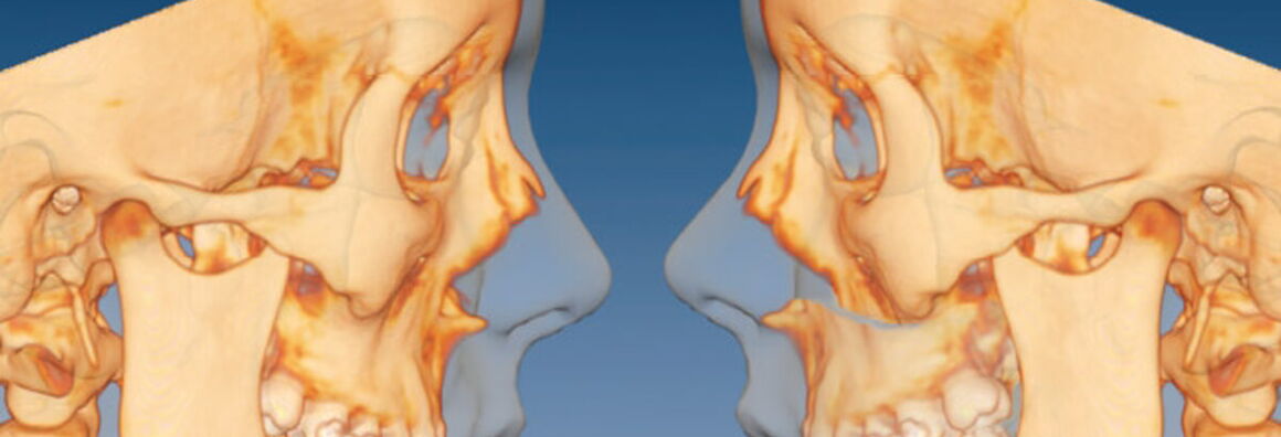 Zwei Schädel, um die herum die dazugehörigen Gesichter angedeutet sind, schauen einander an.