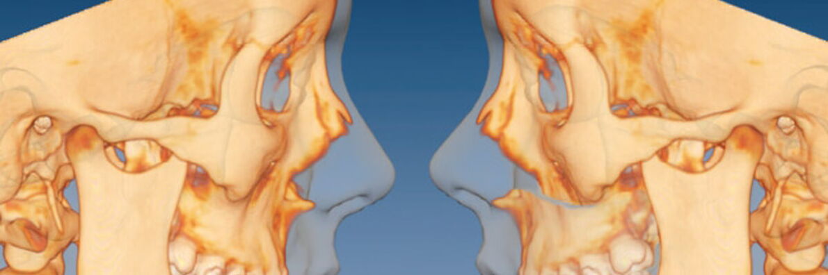 Two skulls, around which the corresponding faces are indicated, look at each other.