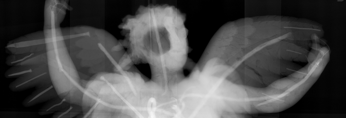 Röntenbild einer Engelsfigur, vom oberen Torso aufwärts.